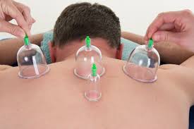 Certificate Course In Cupping Therapy 